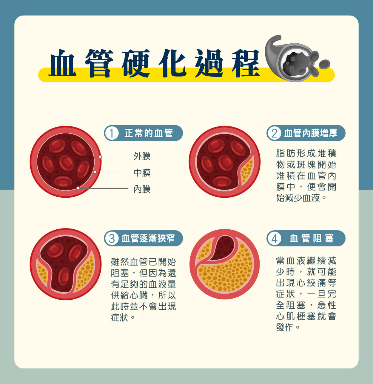 造成血管硬化的原因?